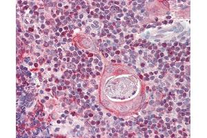 Anti-SATB1 antibody IHC of human thymus. (SATB1 anticorps  (AA 668-681))