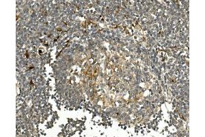 IHC analysis of HGS using anti-HGS antibody (ABIN7601205).