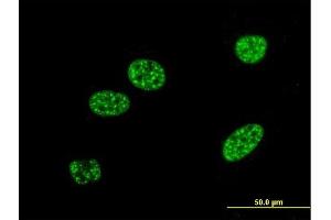 Immunofluorescence of monoclonal antibody to BNIP3L on HeLa cell. (BNIP3L/NIX anticorps  (AA 43-130))