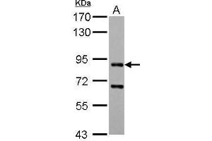WB Image CD2AP antibody detects CD2AP protein by Western blot analysis. (CD2AP anticorps)