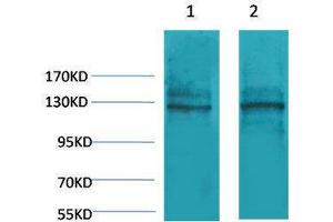 Western Blotting (WB) image for anti-Calcium-Sensing Receptor (CASR) antibody (ABIN3181546) (CASR anticorps)