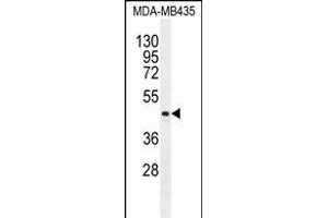 LIPK Antibody (C-term) (ABIN655861 and ABIN2845266) western blot analysis in MDA-M cell line lysates (35 μg/lane).