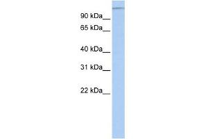 WB Suggested Anti-MTUS1 Antibody Titration:  0. (MTUS1 anticorps  (Middle Region))