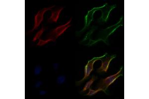 ABIN6266305 and ABIN6277424 staining Hela cells by IF/ICC. (PDK4 anticorps  (C-Term))