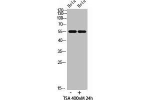 Western blot analysis of hela cells,hela cells, antibody was diluted at 500. (HNF4A anticorps  (acLys106))