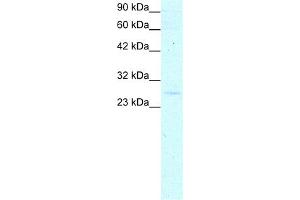 WB Suggested Anti-YEATS4 Antibody Titration:  0. (GAS41 anticorps  (Middle Region))
