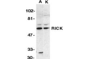 Image no. 1 for anti-Receptor-Interacting Serine-threonine Kinase 2 (RIPK2) (N-Term) antibody (ABIN201933) (RIPK2 anticorps  (N-Term))