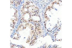 IHC analysis of DDX1 using anti-DDX1 antibody (ABIN7602050).