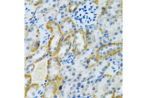 Immunohistochemistry of paraffin-embedded rat kidney using GDAP1 antibody (ABIN2562793) at dilution of 1:100 (40x lens). (GDAP1 anticorps)