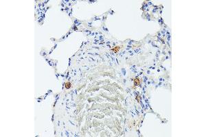 Immunohistochemistry of paraffin-embedded rat lung using TI antibody (ABIN6133213, ABIN6149144, ABIN6149145 and ABIN6221696) at dilution of 1:100 (40x lens).