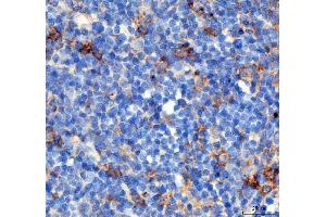 IHC analysis of PDCD1 using anti PDCD1 antibody (ABIN5518784). (PD-1 anticorps  (N-Term))