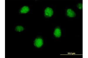 Immunofluorescence of purified MaxPab antibody to RARB on HeLa cell.