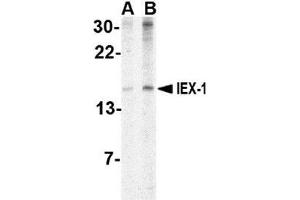 Western blot analysis of IEX1 in human brain tissue lysate with AP30400PU-N IEX1 antibody at (A) 2 and (B) 4 μg/ml. (IER3 anticorps  (Center))