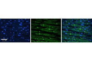 Rabbit Anti-HLA-DMB Antibody Catalog Number: ARP63380_P050 Formalin Fixed Paraffin Embedded Tissue: Human heart Tissue Observed Staining: Plasma membrane in intercalated disk Primary Antibody Concentration: 1:100 Other Working Concentrations: N/A Secondary Antibody: Donkey anti-Rabbit-Cy3 Secondary Antibody Concentration: 1:200 Magnification: 20X Exposure Time: 0.