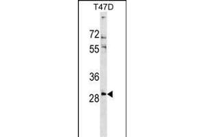 RN Antibody (Center) (ABIN1538610 and ABIN2849190) western blot analysis in T47D cell line lysates (35 μg/lane). (RNF138 anticorps  (AA 76-103))