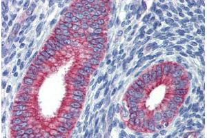 Uterus, Human: Formalin-Fixed, Paraffin-Embedded (FFPE) (ZNF71 anticorps  (C-Term))