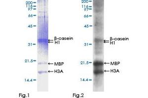 Western Blotting (WB) image for FYN Oncogene Related To SRC, FGR, YES (FYN) (AA 1-482) protein (GST tag) (ABIN1354567)