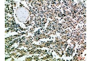 Immunohistochemical analysis of paraffin-embedded Human-spleen, antibody was diluted at 1:100 (CD52 anticorps  (AA 20-50))