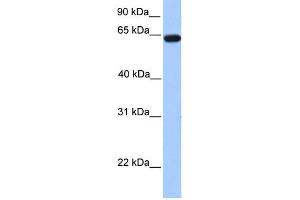 WB Suggested Anti-ZNF342 Antibody Titration:  0. (Zinc Finger Protein 296 (ZNF296) (N-Term) anticorps)