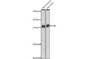 Western blot analysis of extracts of various cell lines, using VHL antibody (ABIN7271338) at 1:3000 dilution.
