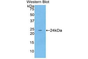 Western Blotting (WB) image for anti-Spectrin alpha Chain, Brain (SPTAN1) (AA 22-210) antibody (ABIN3208896) (SPTAN1 anticorps  (AA 22-210))