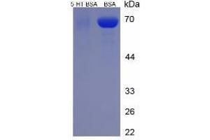 Image no. 2 for 5-Hydroxytryptamine (5-HT) protein (BSA) (ABIN1880100) (Serotonin Protein (BSA))