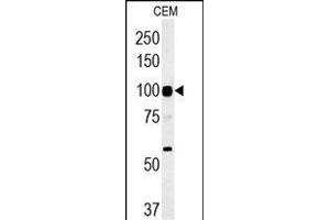 ATP6V0A4 Antibody (Center) (ABIN651562 and ABIN2840303) western blot analysis in CEM cell line lysates (35 μg/lane). (ATP6V0A4 anticorps  (AA 235-261))