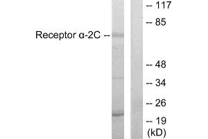 Western blot analysis of extracts from HepG2 cells, using Adrenergic Receptor alpha -2C antibody. (ADRA2C anticorps  (C-Term))