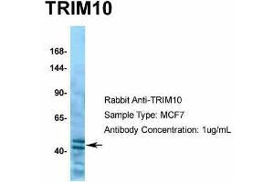Human MCF7; Host: Rabbit. (TRIM10 anticorps  (C-Term))