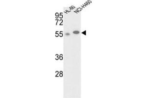 Western Blotting (WB) image for anti-Galactokinase 2 (GALK2) antibody (ABIN3002978) (GALK2 anticorps)