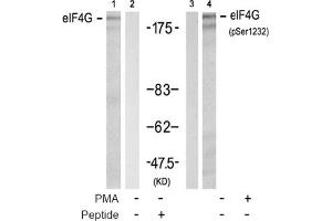 Image no. 2 for anti-Eukaryotic Translation Initiation Factor 4 Gamma, 1 (EIF4G1) (pSer1232) antibody (ABIN319277) (EIF4G1 anticorps  (pSer1232))