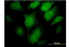 Immunofluorescence (IF) image for anti-Proprotein Convertase Subtilisin/kexin Type 1 (PCSK1) (AA 652-754) antibody (ABIN781869)