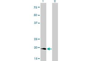 Western Blot analysis of NUDT10 expression in transfected 293T cell line by NUDT10 monoclonal antibody (M01), clone 2F8.