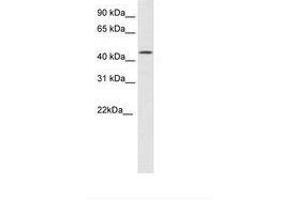 Image no. 1 for anti-High Mobility Group 20B (HMG20B) (N-Term) antibody (ABIN6736097) (HMG20B anticorps  (N-Term))