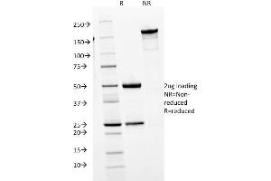 SDS-PAGE Analysis Purified IgM Mouse Monoclonal Antibody (IGHM/1623). (IGHM anticorps)