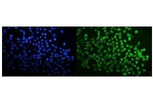 IF analysis of SPAK/STK39 using anti-SPAK/STK39 antibody (ABIN7601373). (STK39 anticorps  (AA 338-545))