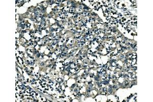 IHC analysis of CDK16 using anti-CDK16 antibody (ABIN7601590).