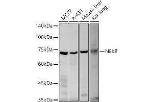 Western blot analysis of extracts of various cell lines, using NEK8 antibody (ABIN3021225, ABIN3021226, ABIN3021227 and ABIN6214075) at 1:500 dilution. (NEK8 anticorps  (AA 1-300))