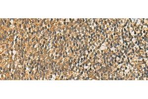 Immunohistochemistry of paraffin-embedded Human tonsil tissue using FAAP100 Polyclonal Antibody at dilution of 1:50(x200)