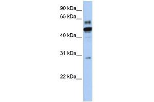 ESRRA antibody used at 1 ug/ml to detect target protein. (ESRRA anticorps  (N-Term))