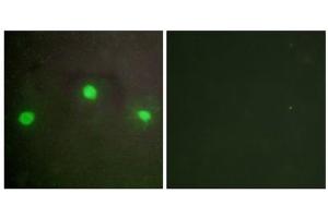 Immunofluorescence analysis of A549 cells, using ATRX antibody. (ATRX anticorps  (N-Term))