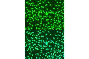Immunofluorescence analysis of U2OS cells using CCNA2 antibody. (Cyclin A anticorps)