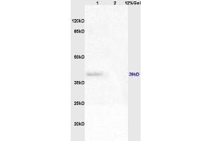 Lane 1: rat brain lysates Lane 2: rat liver lysates probed with Anti Adenovirus 5 E1A Polyclonal Antibody, Unconjugated (ABIN762941) at 1:200 in 4 °C. (Human Adenovirus type 5 E1A (HAdV-5 E1A) (AA 181-280) anticorps)