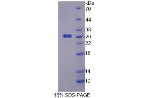 SDS-PAGE analysis of Mouse FADD Protein. (FADD Protéine)