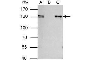 IP Image MCM2 antibody [N1N2], N-term immunoprecipitates MCM2 protein in IP experiments.