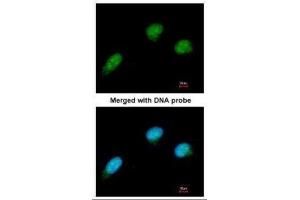 ICC/IF Image Immunofluorescence analysis of paraformaldehyde-fixed HeLa, using CTBP2, antibody at 1:100 dilution. (CTBP2 anticorps  (C-Term))
