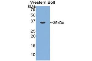 Western blot analysis of the recombinant protein. (Cyclin D1 anticorps  (AA 1-292))