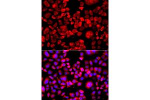 Immunofluorescence analysis of A549 cell using EIF4G1 antibody. (EIF4G1 anticorps)