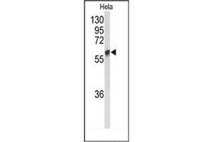 Western blot analysis of GALNT2 Antibody (N-term) in Hela cell line lysates (35ug/lane). (GALNT2 anticorps  (N-Term))