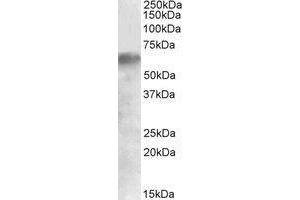 AP23663PU-N IRF2BP1 antibody staining of Human Liver lysate at 0. (IRF2BP1 anticorps  (Internal Region))